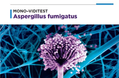 MONO-VIDITEST anti-Aspergillus fumigatus