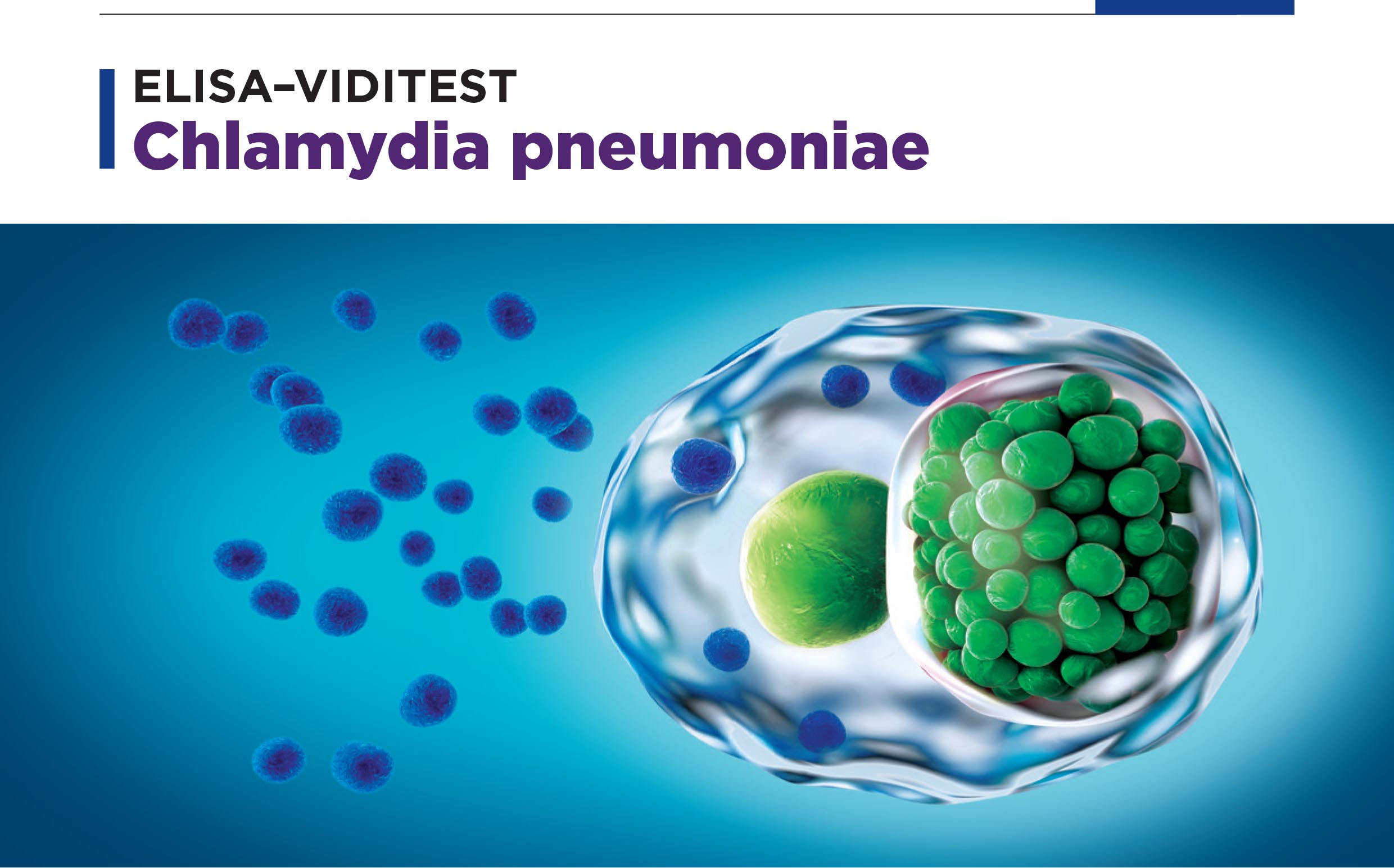 chlamydia pneumoniae elisa