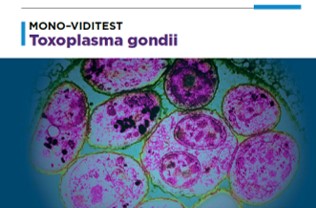 MONO-VIDITEST anti-Toxoplasma gondii